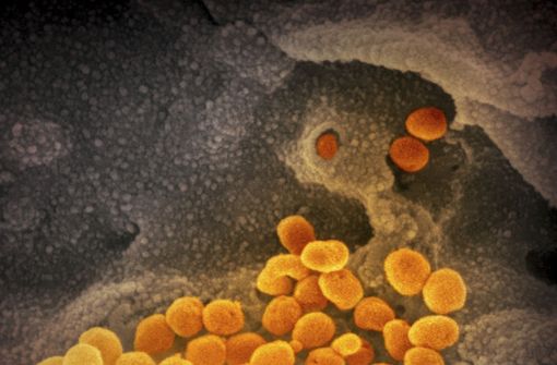 Eine mikroskopische Aufnahme  zeigt das Coronavirus (SARS-CoV-2). Nun soll es eine neue Variante des Virus geben (Symbolfoto). Foto: NIAID-RML/AP/dpa