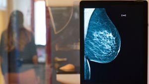 Die gesunde Brust einer Frau ist auf einer Röntgenaufnahme zu sehen. Das Röntgenbild war für einen Trailer des Mammographie-Screening-Programms, einem gesetzlichen Früherkennungsprogramms für Frauen zwischen 50 und 69 Jahren, aufgenommen worden. Foto: Klaus-Dietmar Gabbert/ZB/dpa