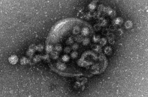 Fieser Erreger: Noroviren haben eine Krankheitswelle in einem Zeltlager in Mödingen ausgelöst. Foto: dpa