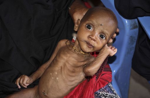 Dieses neun Monate alte Kind ist eines von Zehntausenden in Somalia, die akut vom Hungertod bedroht sind. Foto: AP