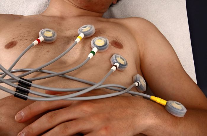 Gesundheitsatlas: Auf einen Termin beim Kardiologen muss man bis zu neun Monate warten