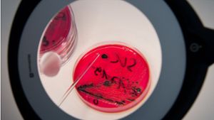 Salmonellen in einer Petrischale. Sie wurden in einem Dessert eines Mannheimer Lebensmittelhändlers entdeckt (Symbolfoto). Foto: dpa/Arno Burgi